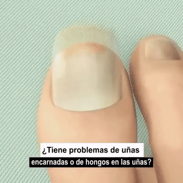 Protección total Dile Adiós a los hongos ClearTips™ ⭐⭐⭐⭐⭐